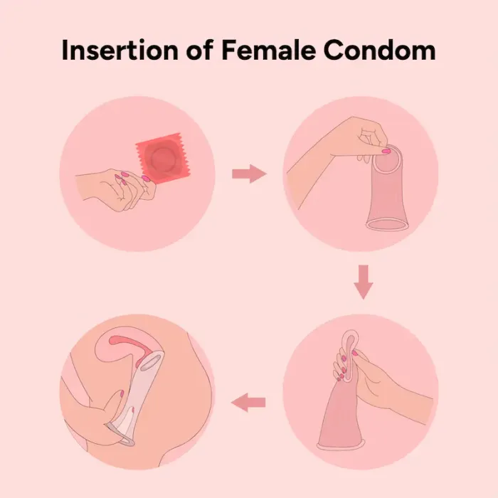 How to Use Female Condoms for Pregnancy Prevention